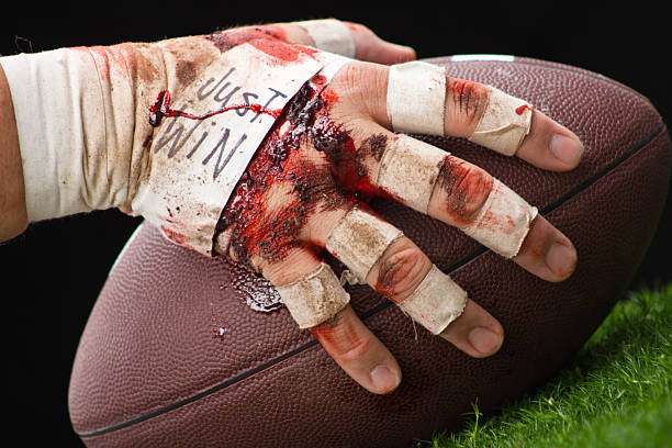 Why do my hands become itchy and red after wearing football gloves for a long time? Analysis of causes and solutions.